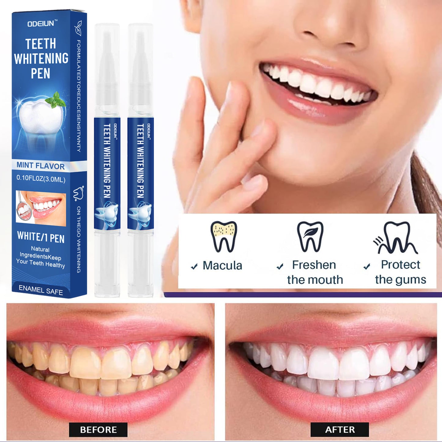 ODEIUN™ Gum Therapy Gel - Upgraded formula