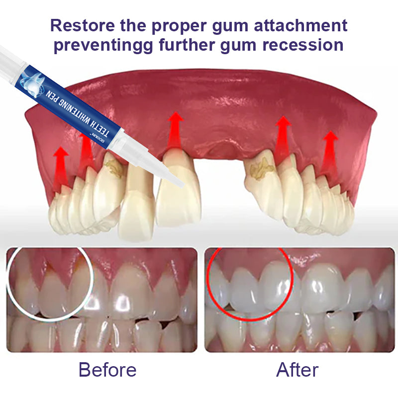 ODEIUN™ Gum Therapy Gel - Upgraded formula