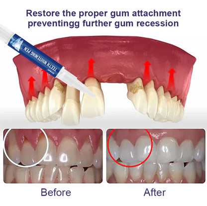 ODEIUN™ Gum Therapy Gel - Upgraded formula