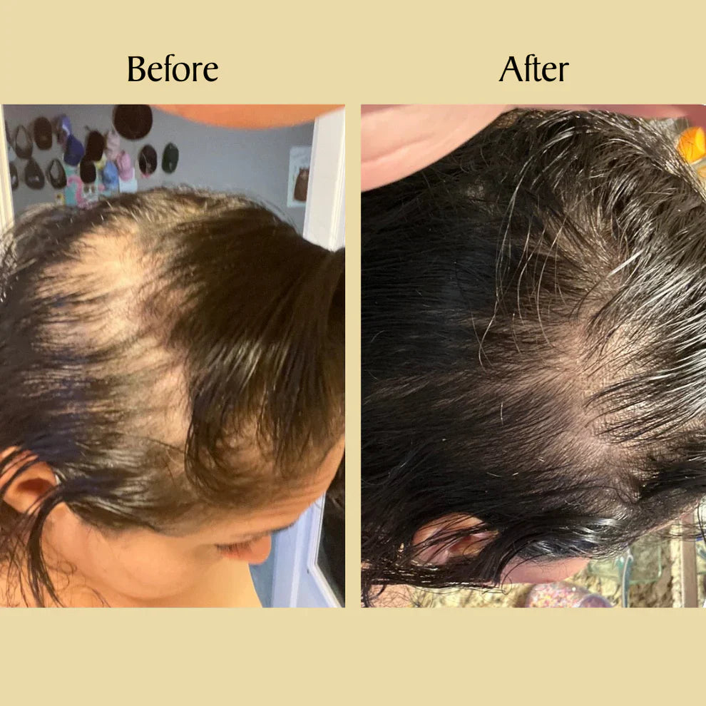 🌿 Natural Hair Growth Oil
