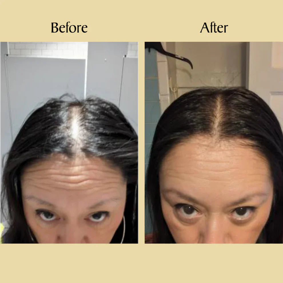 🌿 Natural Hair Growth Oil