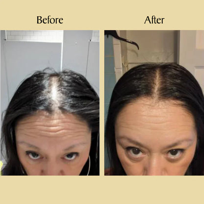 🌿 Natural Hair Growth Oil