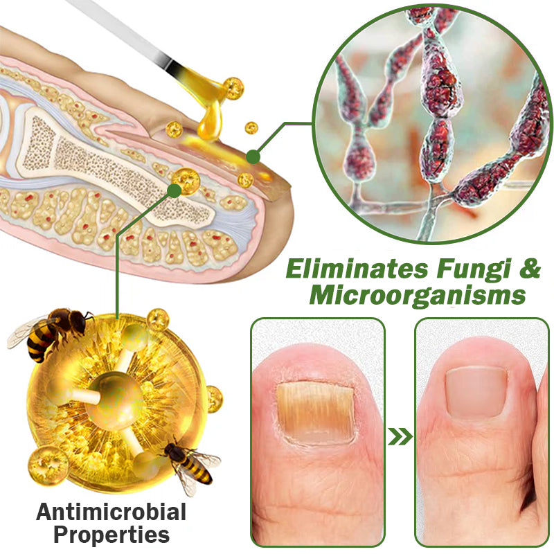 👏Furzero™ Nail Defense Bee Venom Treatment Serum pro