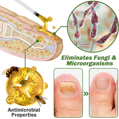 👏Furzero™ Nail Defense Bee Venom Treatment Serum pro