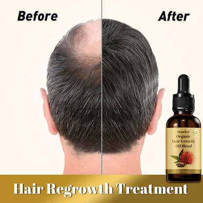 Natural Hair Growth Oil