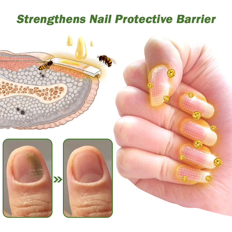 👏Furzero™ Nail Defense Bee Venom Treatment Serum pro