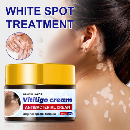 ODEIUN™ Vitiligo Cream - Elimination of deep white blood cells