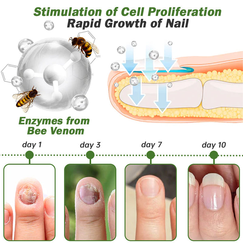 👏Furzero™ Nail Defense Bee Venom Treatment Serum pro