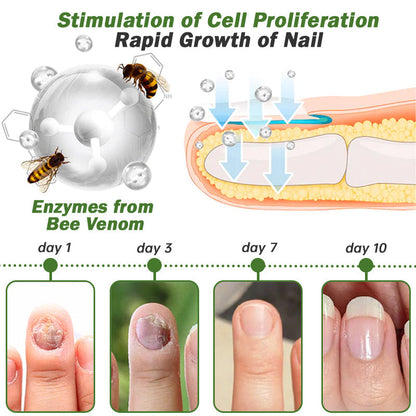 👏Furzero™ Nail Defense Bee Venom Treatment Serum pro