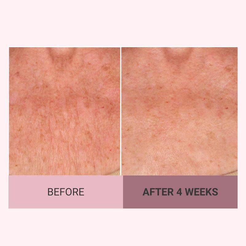 💆‍♀️ Experience Ultimate Luxury - 50% OFF - ✨ Champagne Beaute Lift Firming Body Crème - For Firmer, Smoother, Radiant Skin! 🌟（Buy 3 & Free Shipping）