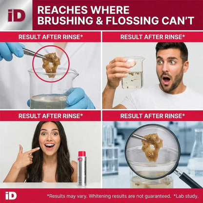 Power Stain-Removing Mouthwash – Brighter Teeth in Every Rinse🦷
