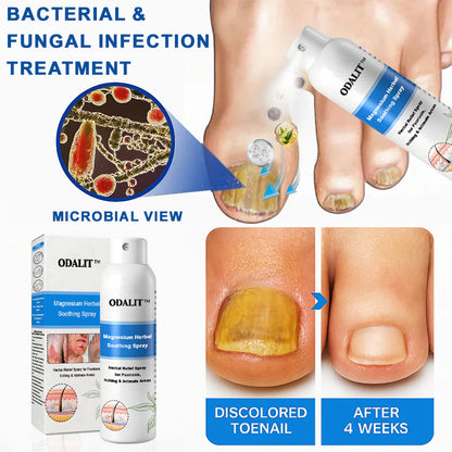 ✅Official Store: ODALIT®Magnesium Herbal Psoriasis Spray⚕️MHRA certified (Eliminates psoriasis and eczema, treats bacterial infections in the genital area, relieves joint pain and neuropathic pain, and treats acne and pigmentation)