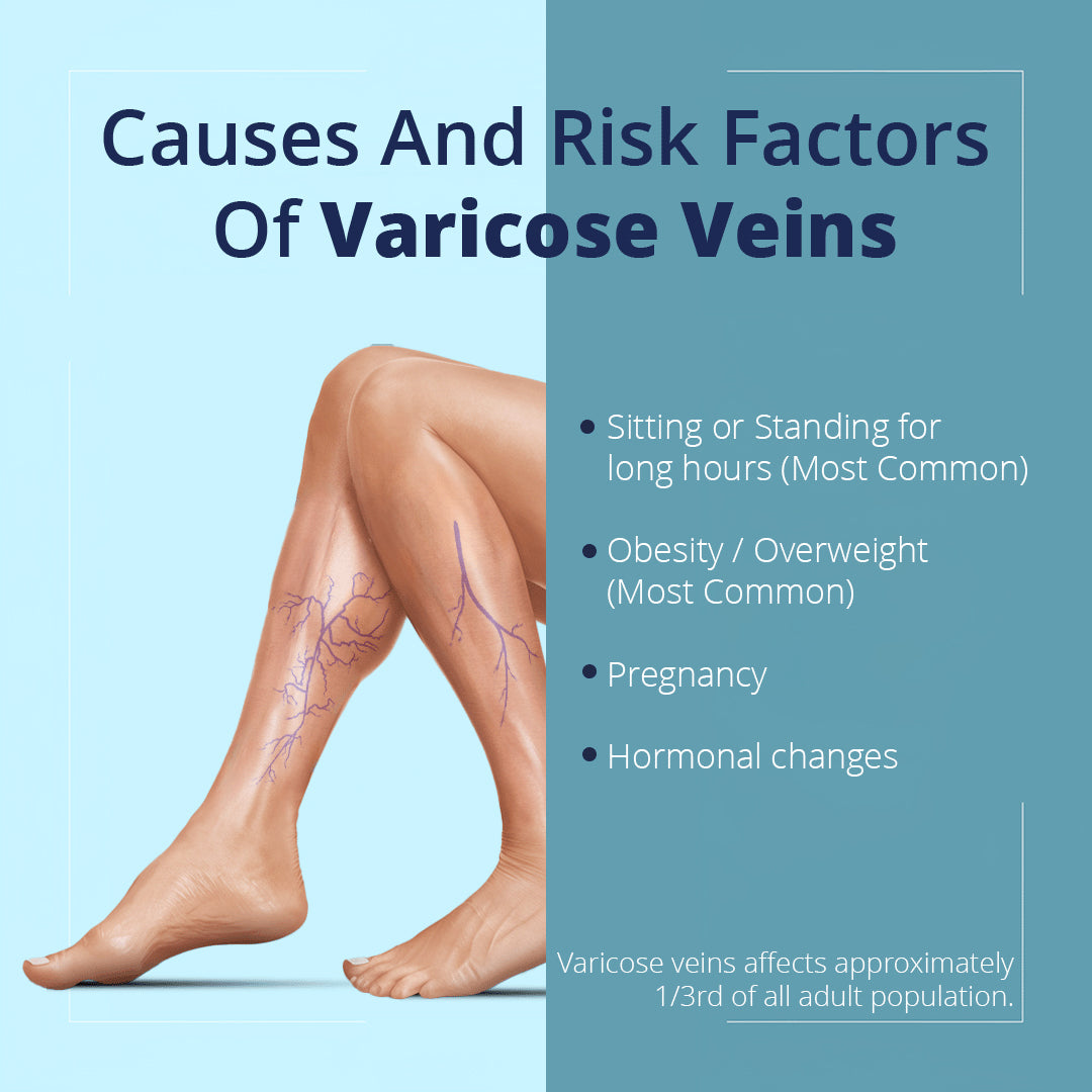 ODEIUN™ Natural Relief Cream for Varicose Veins