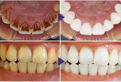ODEIUN™ Gum Therapy Gel - Upgraded formula