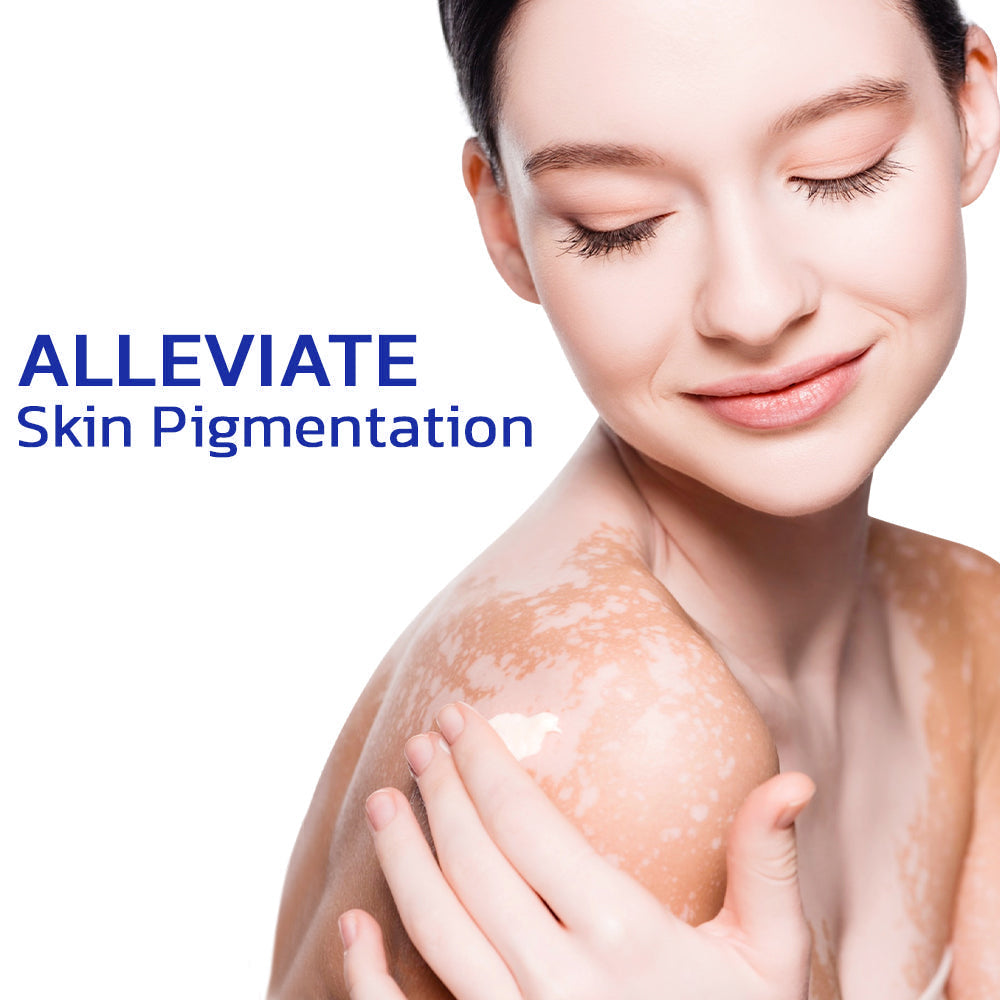 ODEIUN™ BeeVenom Vitiligo Treatment Cream