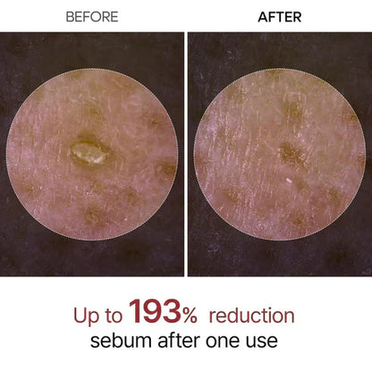 🔥 Instant Glow & Pore Refinement | Rice Ampoule 🌟