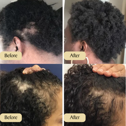 ✨ Natural Hair Growth Oil