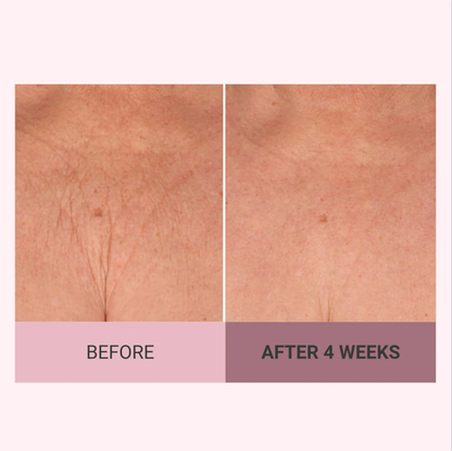 💆‍♀️ Experience Ultimate Luxury - 50% OFF - ✨ Champagne Beaute Lift Firming Body Crème - For Firmer, Smoother, Radiant Skin! 🌟（Buy 3 & Free Shipping）