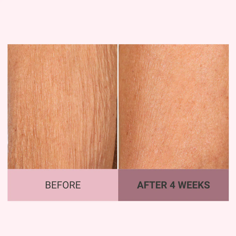 💆‍♀️ Experience Ultimate Luxury - 50% OFF - ✨ Champagne Beaute Lift Firming Body Crème - For Firmer, Smoother, Radiant Skin! 🌟（Buy 3 & Free Shipping）