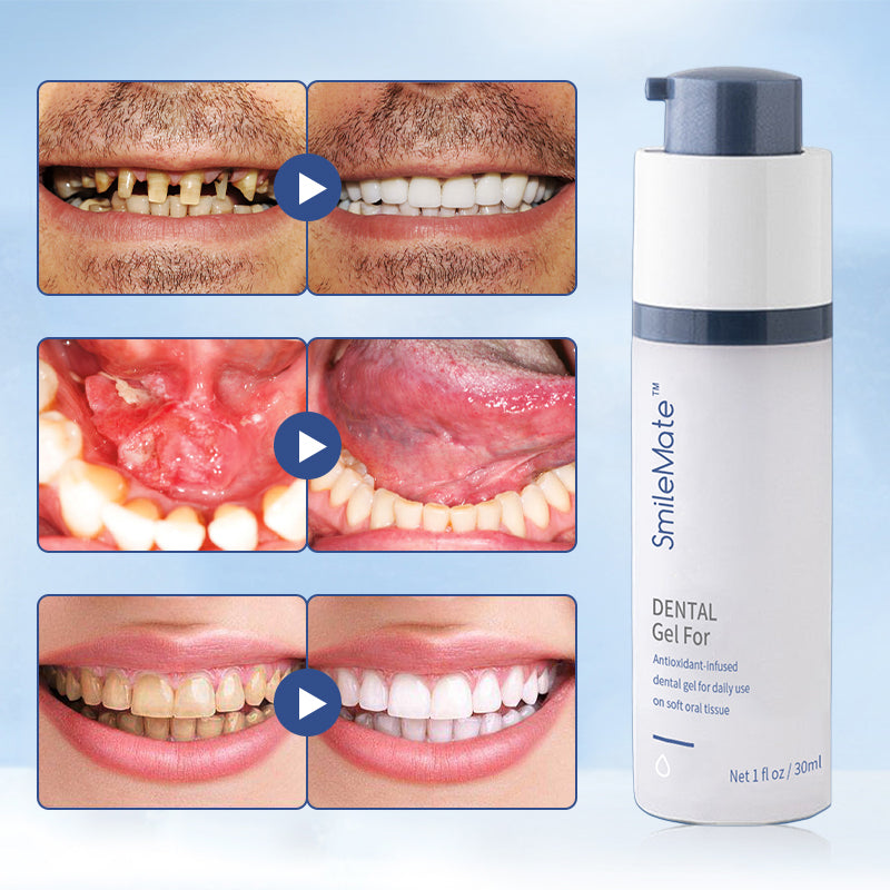 Hot Sale 70% Off-SmileMate™ Teeth Whitening Repair Regrowth Dental Gel