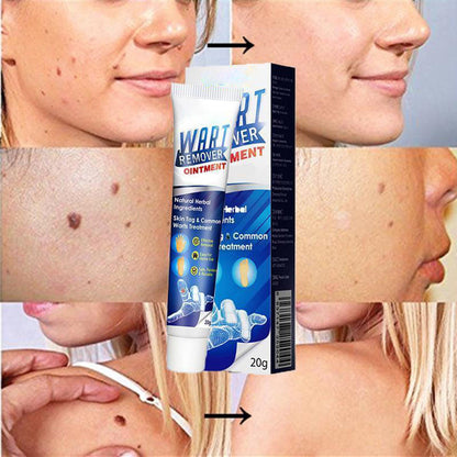 Instant Blemish Wart Remover Gel